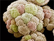 Methaanbacterie <i>Methanosarcina</i> ï¿½ Broad Institute
